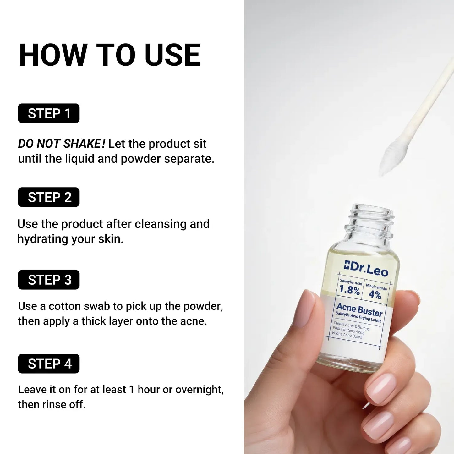 Dr.Leo Drying Lotion | Pimple Treatment & Body Acne Treatment | Visibly Shrinks Pimples in 24 Hours & Helps Fade Acne Marks in 7 Days | With 1.8% Encapsulated Salicylic Acid, 4% Niacinamide & 10% Sulfur (20ml) #mothersdaygift #Summervibes